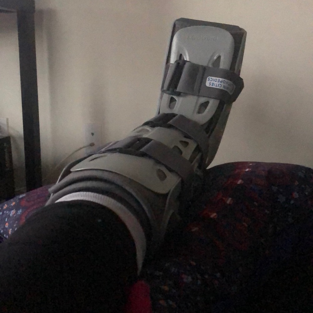 My leg